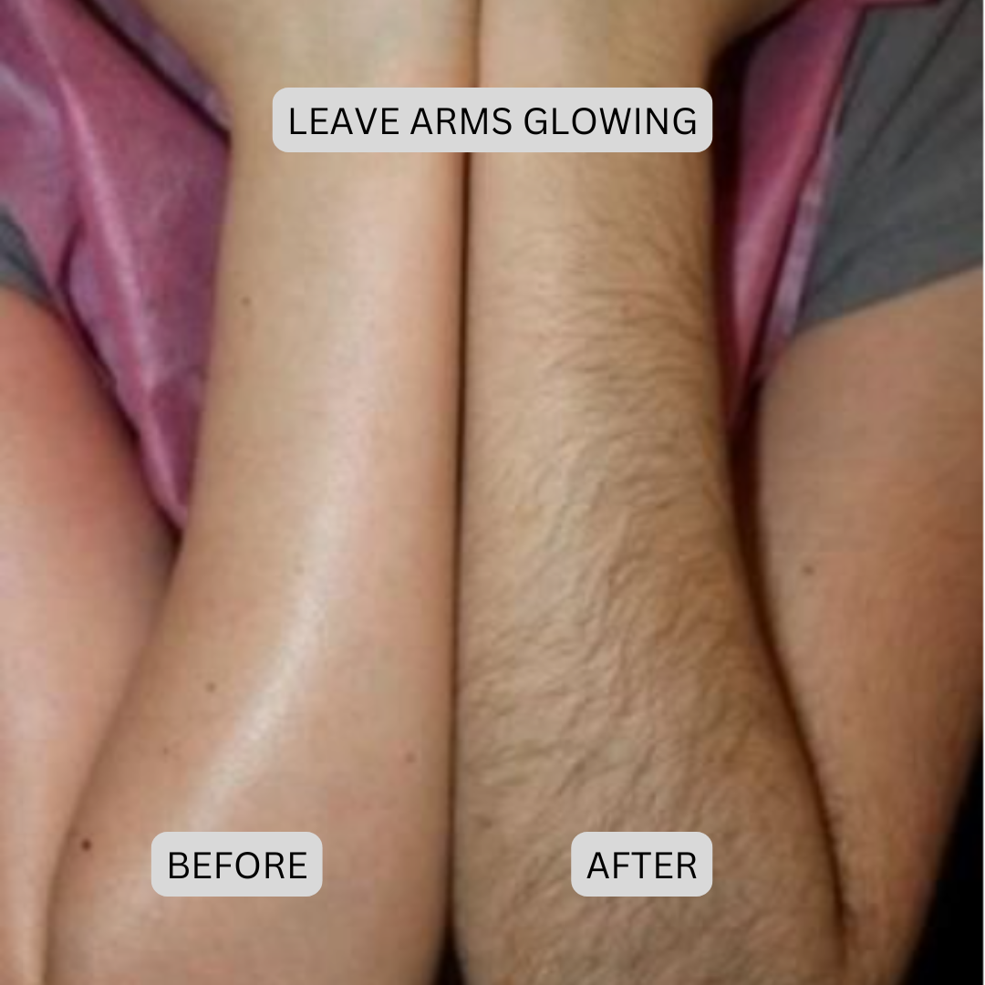 Novera DualTech Bikini Trimmer: Precision Grooming Without Skin Contact