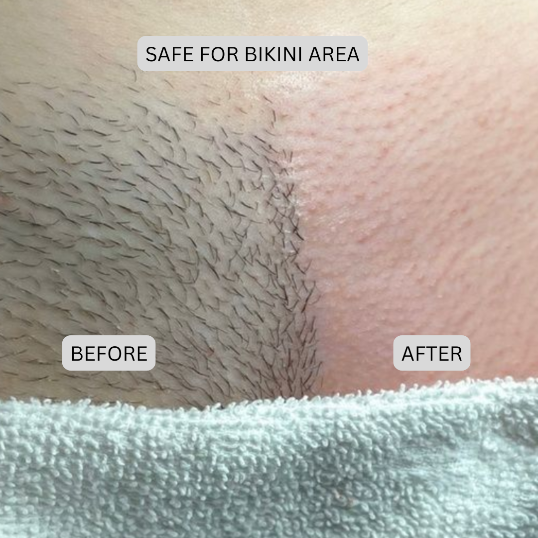 Novera DualTech Bikini Trimmer: Precision Grooming Without Skin Contact