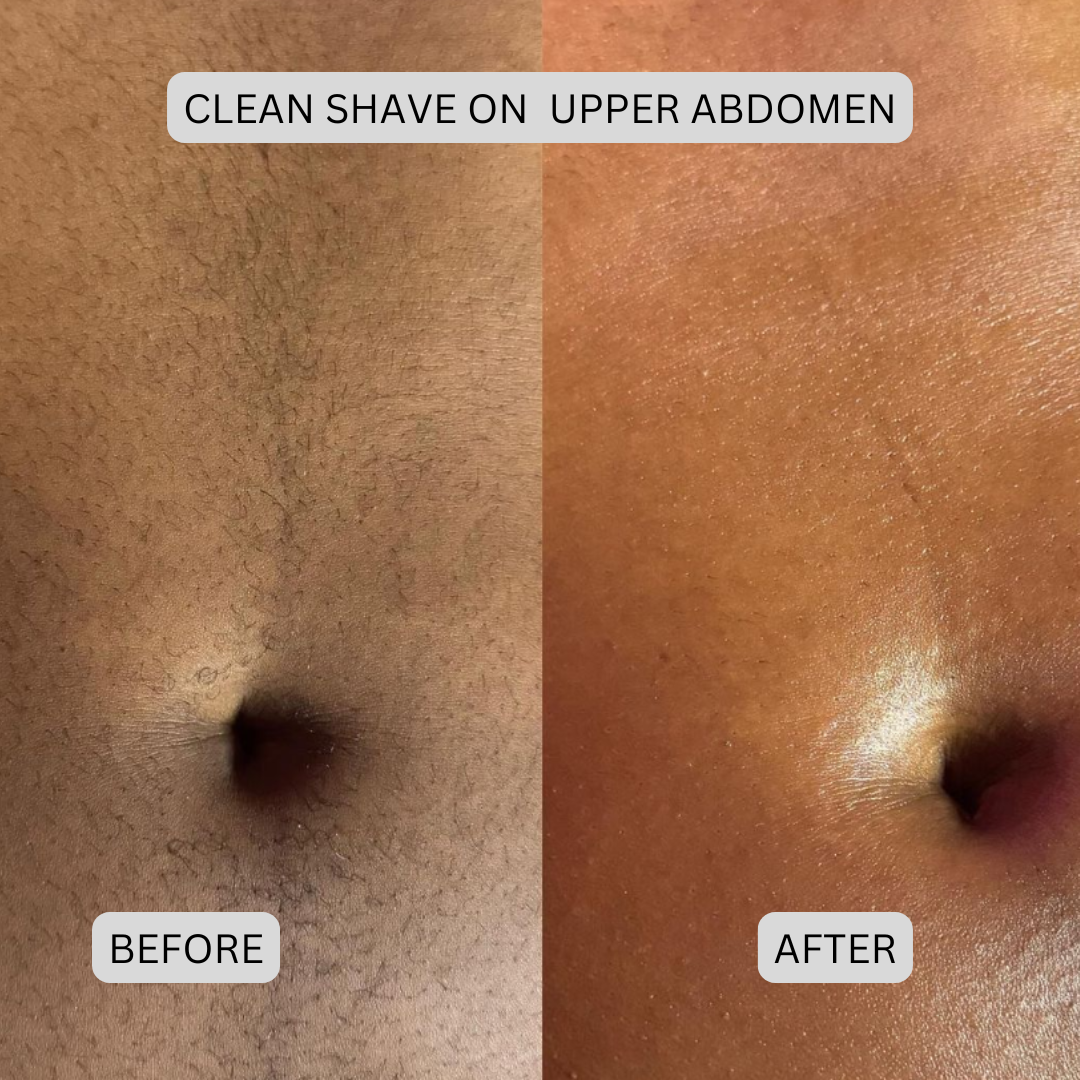 Novera DualTech Bikini Trimmer: Precision Grooming Without Skin Contact