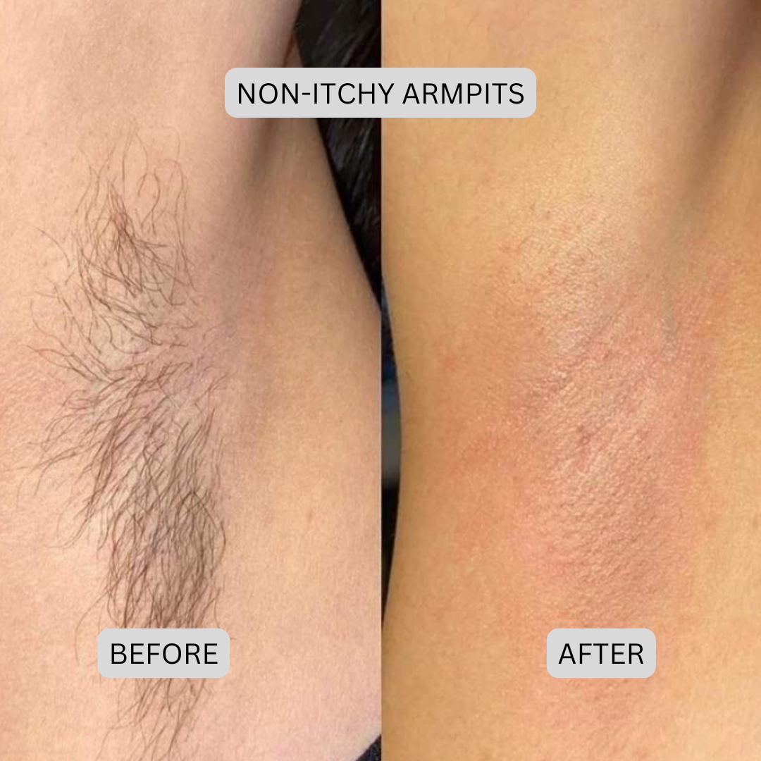 Novera DualTech Bikini Trimmer: Precision Grooming Without Skin Contact