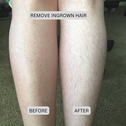 Novera DualTech Bikini Trimmer: Precision Grooming Without Skin Contact
