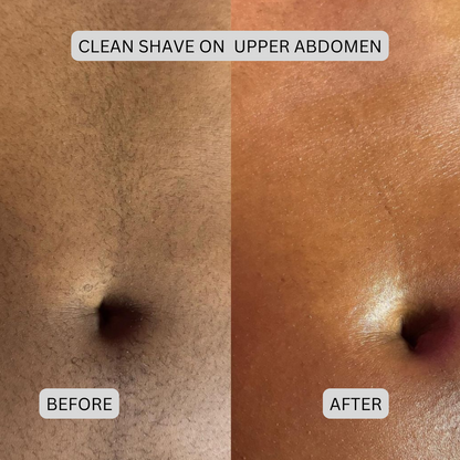 Novera DualTech Bikini Trimmer: Precision Grooming Without Skin Contact